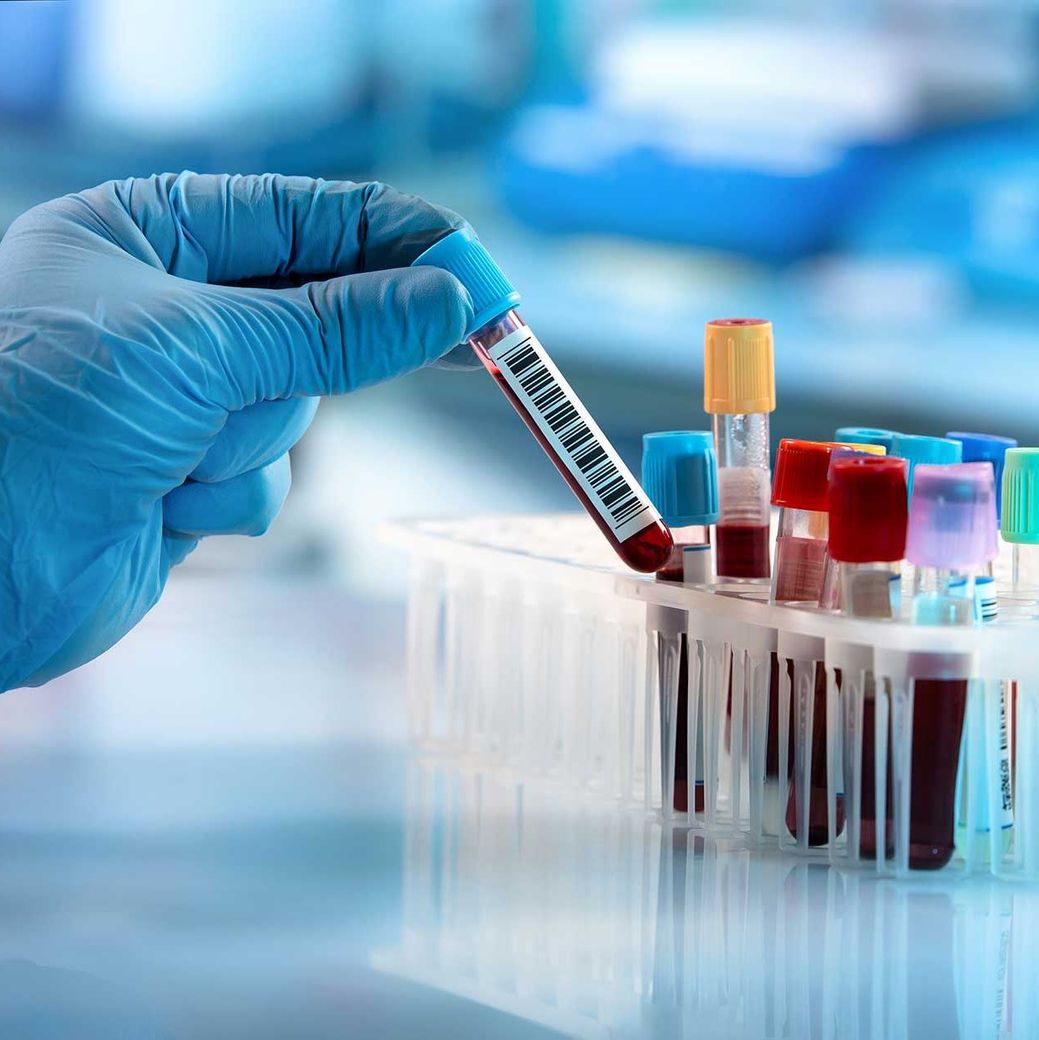Arzt nimmt ein Blutprobenröhrchen aus einem Regal mit Analysegeräten im Labor