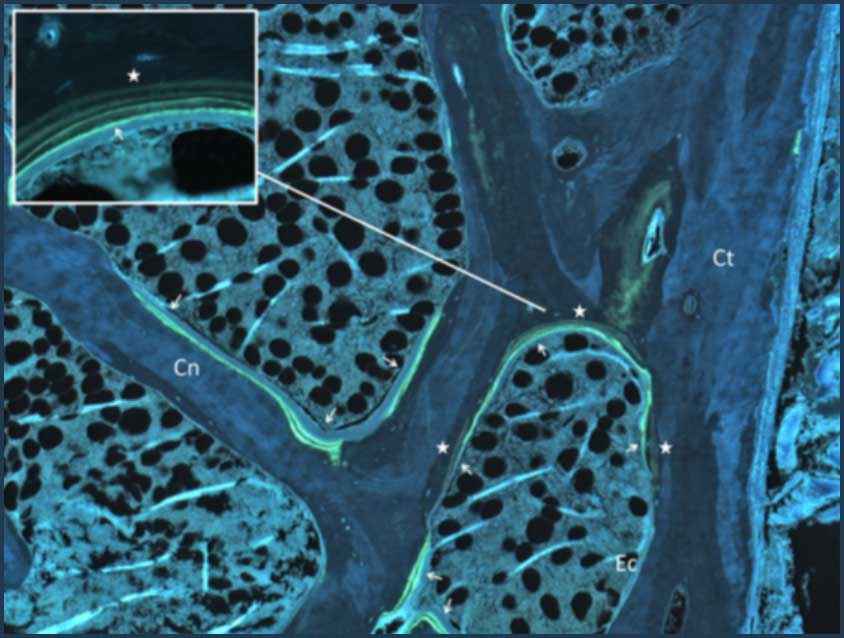 Mikroskopische Darstellung des Knochens