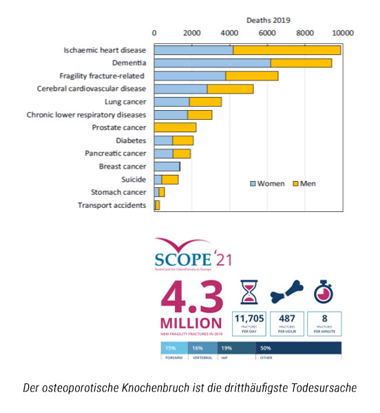 Der osteoporotische Knochenbruch ist die dritthäufigste Todesursache