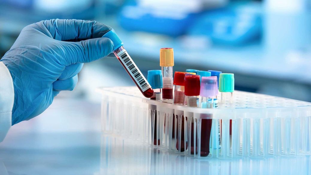Arzt nimmt ein Blutprobenröhrchen aus einem Regal mit Analysegeräten im Labor